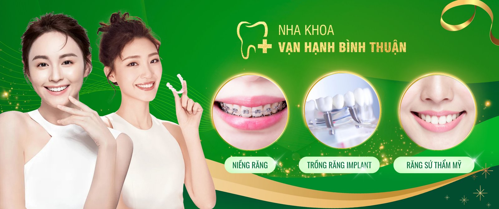 Niềng răng